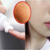 Cách làm se khít lỗ chân lông bằng kem đánh răng nguyên chất